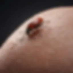 Illustration of a red, swollen bug bite with a central puncture mark