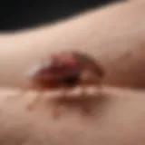 Close-up of red, swollen bed bug bite on arm