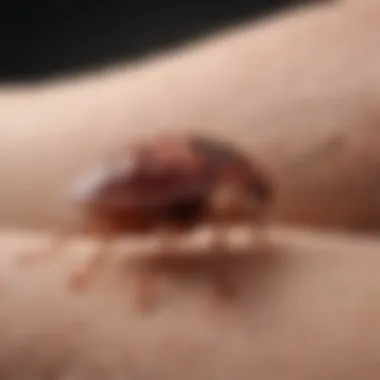 Close-up of red, swollen bed bug bite on arm