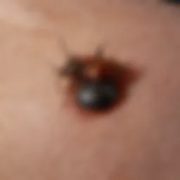 Close-up of an insect bite on skin
